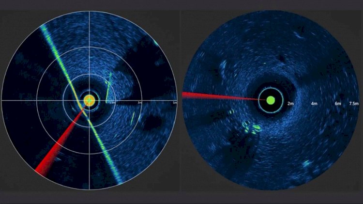 Word’s smallest imaging sonar launched